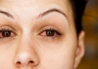 Nhiều bệnh nhân Covid-19 xuất hiện triệu chứng đặc biệt