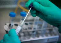 Dịch vụ xét nghiệm PCR quá tải