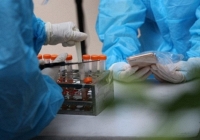 Bộ Y tế yêu cầu xử phạt việc 'thổi giá' kit xét nghiệm