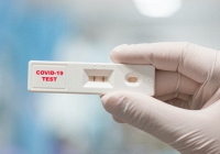 Chuyên gia cảnh báo khẩn việc người dân liên tục test nhanh vì lo sợ mắc Covid-19