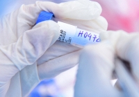 Việt Nam sẽ gặp khó khăn, thách thức nào khi ứng phó đậu mùa khỉ?