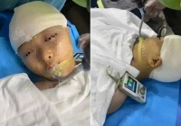Vụ nữ sinh bị 'tác động vật lý' đến mức vỡ hộp sọ: Quá khứ của thầy giáo bị vạch trần