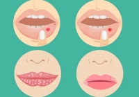 4 dấu hiệu bệnh nghiêm trọng có thể xuất hiện ở môi: Nếu thấy cần đi khám ngay