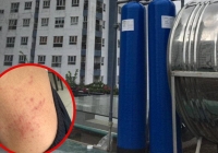 Hàng trăm hộ dân chung cư ở Hà Nội yêu cầu làm rõ nguồn nước sạch gây mẩn ngứa