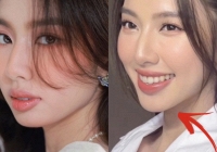 Hoa hậu Thuỳ Tiên vướng nghi vấn 'dao kéo', bị soi điểm khác lạ trên gương mặt
