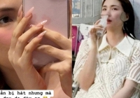 Sau vấn đề liên quan cổ họng, Hoà Minzy tiếp tục lộ tình trạng sức khoẻ đáng lo