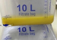 Đau bụng dữ dội, người đàn ông nhập viện 'hút ra 1 lít dầu' trong máu