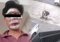 Con trai bị bắt cóc đòi tiền chuộc 1,5 tỷ VNĐ, bố bị thương khắp mặt vì liều mạng giành lại con và câu chuyện khó hiểu phía sau