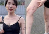 Quỳnh Nga lộ chân tay bầm tím khi vừa được 'hồi sinh' tại Đạp gió, Lệ Quyên liền trao luôn danh hiệu