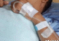 24 tuổi đã bị ung thư ruột nhắm tới chỉ bởi một thức uống 'vui miệng', bác sĩ cảnh báo thói xấu nhiều người hay mắc