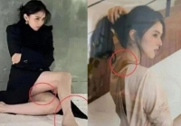 Truyền thông Hoa ngữ đặt nghi vấn Han So Hee bị bạo hành do xuất hiện nhiều vết bầm tím trên cơ thể