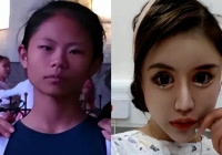 Cô gái nghiện làm đẹp từ năm 13 tuổi, chi 14 tỷ đồng để phẫu thuật thẩm mỹ, hiện tại hối hận nhưng đã muộn màng