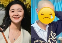  'Sao nhí được yêu thích nhất' mắc bệnh u não hiếm gặp, hình ảnh hiện tại khiến netizen không khỏi xót xa