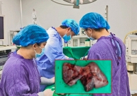 Hà Nội: Bị tai nạn giao thông xong về nhà ngủ, thanh niên 19 tuổi suýt mất mạng vì điều này