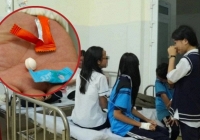 30 học sinh nghi mắc rối loạn phân ly sau khi ăn kẹo lạ, chứng bệnh này nguy hiểm thế nào?