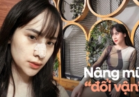Hành trình nâng mũi 'đổi vận' của cô gái 9x: Được cả gia đình 'tháp tùng' đi thẩm mỹ và nhan sắc thay đổi bất ngờ