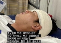 Dùng xe tải chở cầu thủ bị rách trán, lộ xương đi bệnh viện thay vì xe cứu thương, Hiệp hội bóng đá Hàn Quốc bị chỉ trích