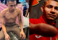 Sức khỏe của cầu thủ Malaysia bị tạt axit 'báo động', tay trái không thể cử động, có nguy cơ giải nghệ