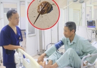 Biết so có độc nhưng vẫn ăn, người đàn ông phải nhập viện rửa dạ dày