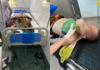 Một người đi theo đoàn ông Thích Minh Tuệ tử vong do sốc nhiệt