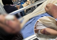 MXH dậy sóng câu chuyện cô gái quê Nghệ An bị bạn trai đánh nhập viện vì tô son đi ăn với hội chị em công ty