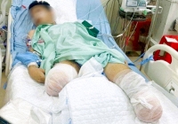 Xót xa gia cảnh của nam sinh bị tai nạn tàu hỏa phải cắt bỏ đôi chân trước kỳ thi tốt nghiệp THPT