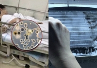 Người đàn ông nhiễm 'vi khuẩn chết người' từ điều hòa, đừng xem nhẹ những tác nhân tàn phá cả gan, thận và phổi