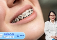 Niềng răng giúp giảm cân, liệu '1 mũi tên có trúng 2 đích'?