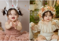 Từng mắc hội chứng lạ khi mới sinh, bé gái 1 tuổi ngày càng nổi tiếng trên MXH nhờ khuôn mặt đáng yêu như thiên thần