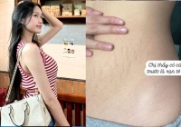 'Hot mom' Doãn Hải My không ngại khoe vết rạn cùng bụng 'màu mỡ' sau sinh 