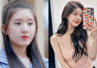 Hot nhất xứ Trung: Triệu Lộ Tư 'dao kéo' toàn bộ gương mặt? 