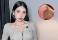 Đã có kết quả kiểm tra loạt thương tích của Hằng Du Mục