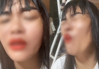 Bị tố 'vét những đồng tiền cuối cùng trong túi bệnh nhân ung thư', Bệnh viện K nói gì?