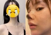 Ngỡ ngàng nhan sắc hiện tại của nữ diễn viên biến chứng 'dao kéo' kinh hoàng nhất showbiz một thời