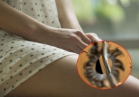 Người phụ nữ sợ hãi khi bác sĩ lấy 1 vật ra khỏi vùng kín