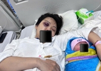 Vụ bạo hành chấn động: Vợ bầu 39 tuần bị chồng tác động gãy sàn ổ mắt và đằng sau là câu chuyện 5 tháng hôn nhân địa ngục