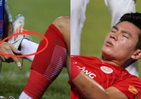 Cầu thủ điển trai nhất nhì U23 Việt Nam bật khóc vì chấn thương lật cổ chân, phải rời sân bằng càng trong ngày đối đầu Tiến Linh