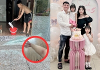 Bùi Tiến Dũng - Khánh Linh bị thương vì sợ cố vỡ cửa kính, mẹ vợ phản ứng bất ngờ: 'Tưởng vợ chồng uýnh nhau'