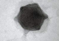 Phát hiện loại virus khổng lồ mới có khả năng lây nhiễm trên tảo nước ngọt.