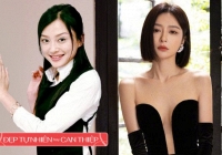 Mỹ nhân 'Diên Hi Công Lược' có nhan sắc “lão hoá ngược” thừa nhận “ai mà không thẩm mỹ”