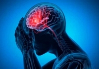 Ô nhiễm không khí có thể làm tăng nguy cơ xuất huyết não