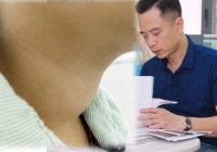 Bé trai 10 tuổi bị cường giáp chuyển suy giáp chỉ sau vài tháng: Nguyên nhân cha mẹ không thể ngờ