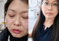 Người phụ nữ lão hóa nhanh như tụt dốc không phanh chỉ trong 20 ngày