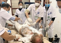 Mâu thuẫn với vợ, người đàn ông lấy xăng tự thiêu