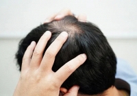 Rụng lông tóc ở ba vùng trên cơ thể có thể là dấu hiệu của bệnh truyền nhiễm