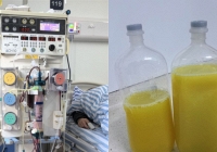 Lọc ra 2 chai 'mỡ' đục ngầu từ máu người phụ nữ, tất cả do một món ngon yêu thích mỗi ngày