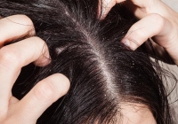 Ngứa da dầu, người đàn ông qua đời sau 3 tháng: 4 cơn ngứa cảnh báo bệnh nặng hoặc ung thư