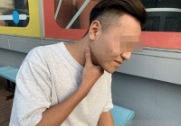 Bỏ qua 1 triệu chứng với giọng nói, 9 tháng sau người đàn ông phát hiện ung thư thanh quản giai đoạn cuối