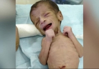 Bé gái sơ sinh bị chôn sống tại Ấn Độ được giải cứu