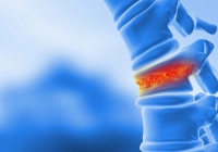 Các nhà khoa học phát triển kỹ thuật tái tạo xương từ mỡ cơ thể